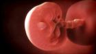 Когда плод (эмбрион) становится человеком?